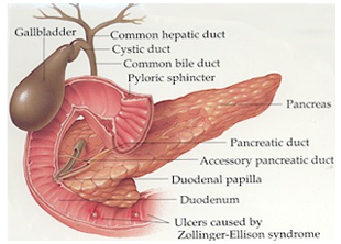diseases of the Pancreas Treatment India,  India Pancreas Treatment Surgeons offers info on Pseudo cysts of the Pancreas India